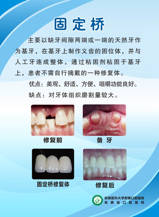变态视频
