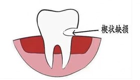 变态视频