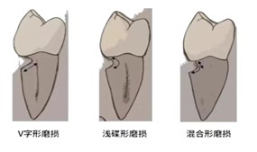 变态视频