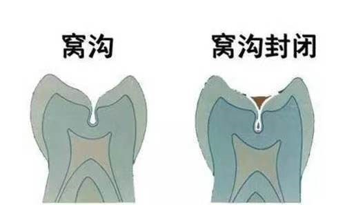变态视频