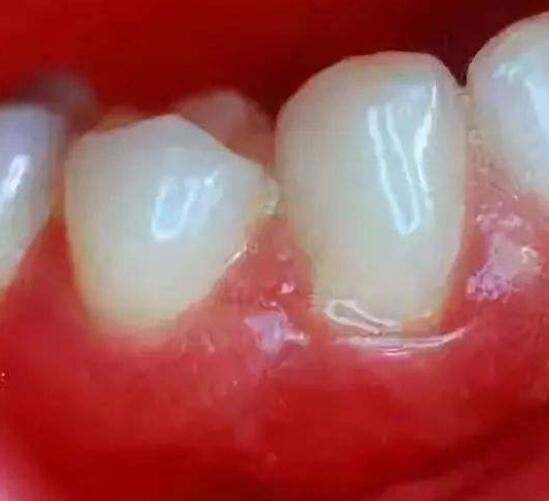变态视频