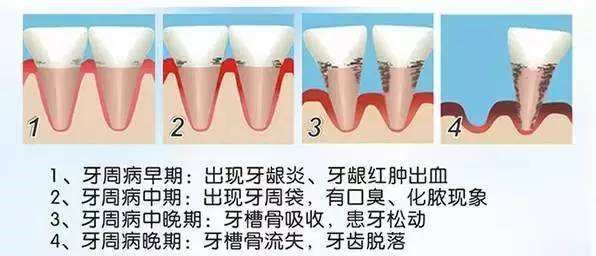 变态视频