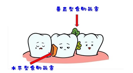变态视频