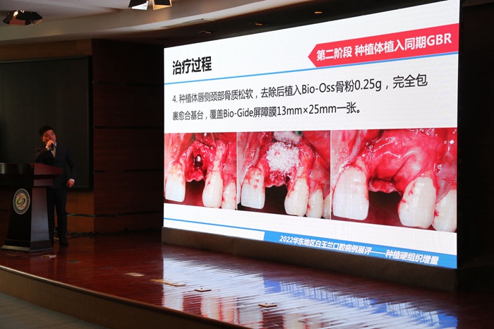 变态视频