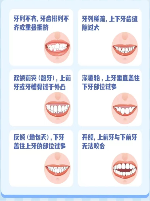 变态视频