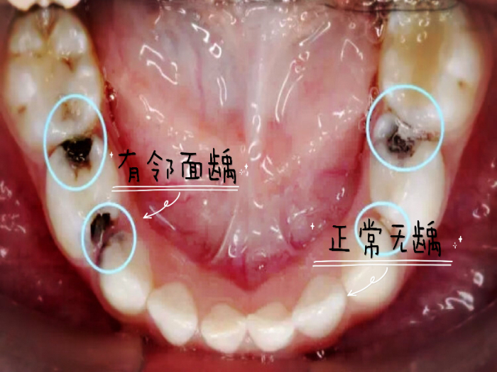 变态视频