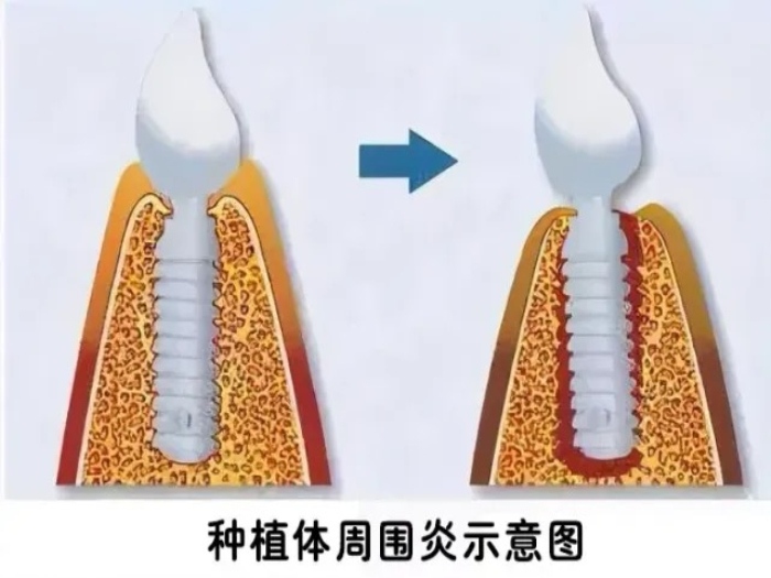 变态视频