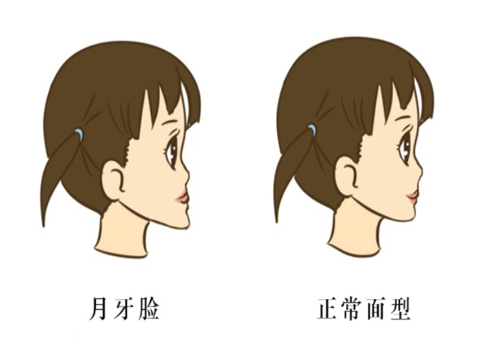 变态视频