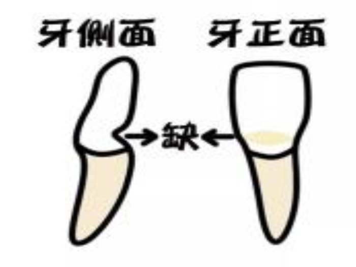 变态视频