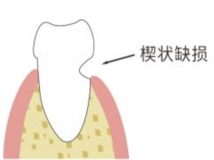 变态视频
