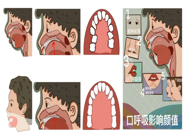 变态视频