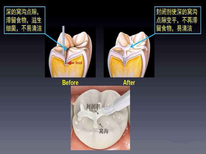 变态视频