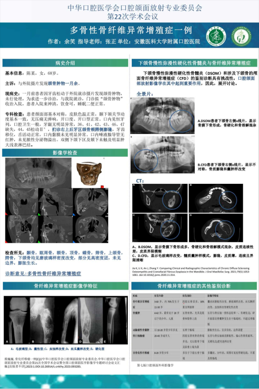 变态视频